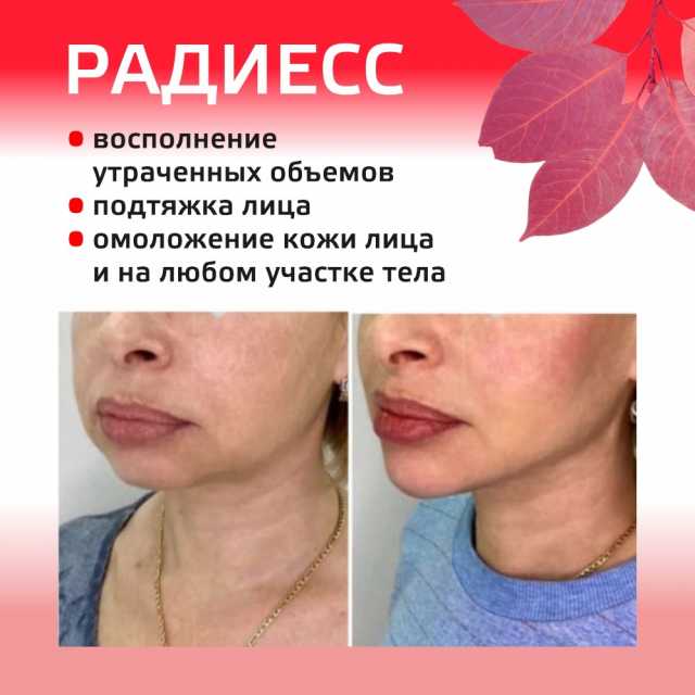 Поможем вернуть свежесть, молодость и четкий овал лица!